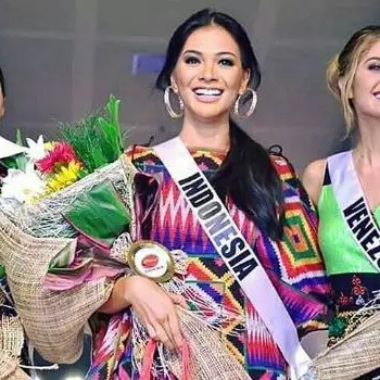 Dapat gelar Miss Phoenix Smile, ini 10 bukti senyum maut Kezia Warouw