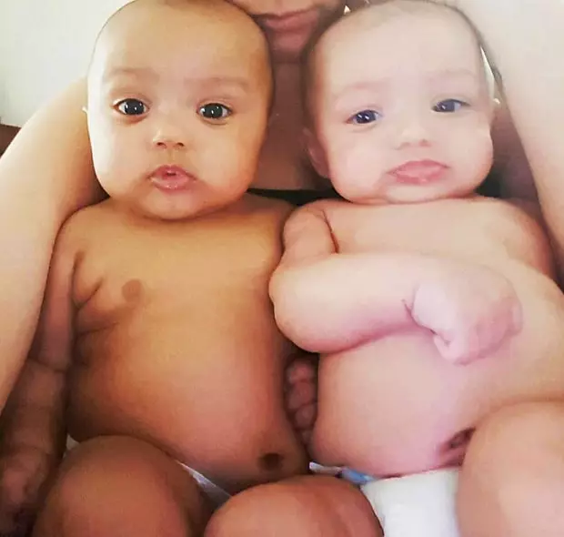 10 Foto bayi kembar beda warna kulit ini dua-duanya ngegemesin
