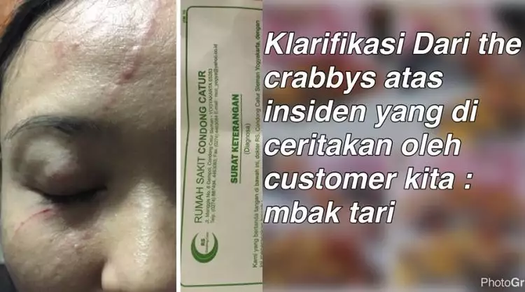 Insiden konsumen vs owner The Crabbys sudah dilaporkan ke YLKI