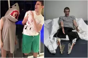 15 Orang ini tetap punya selera humor tinggi meski cacat, bikin ketawa