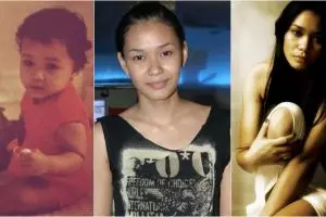 10 Transformasi Adinia Wirasti, si gigi kelinci yang makin cantik