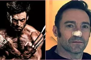 Kembali kena kanker kulit, ini pesan Hugh Jackman untuk penggemarnya