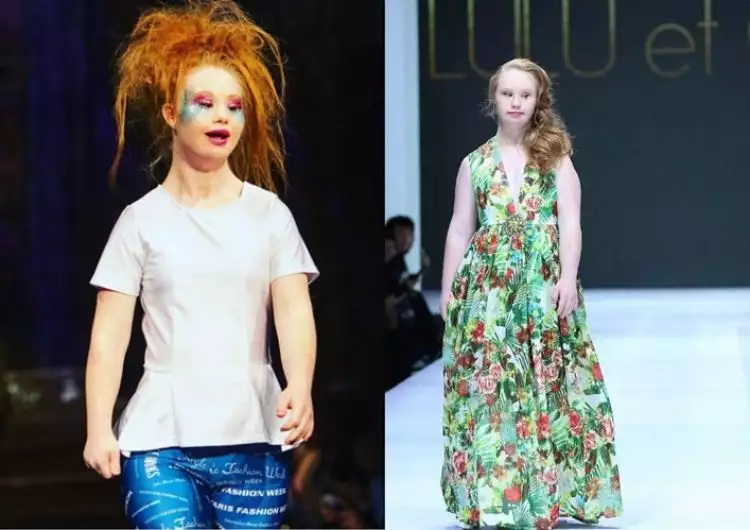 Kisah pengidap down syndrome yang sukses di gelaran fashion dunia