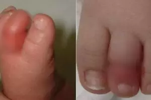 Bayi pakai kaus kaki ini menangis tanpa henti, kenapa ya?
