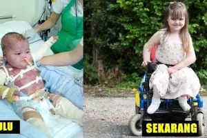 Divonis peluang hidup 5%, bocah ini bertahan usai jalani 340 operasi