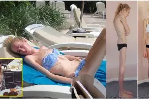 Divonis usianya tinggal 48 jam, gadis ini perlahan berubah jadi cantik