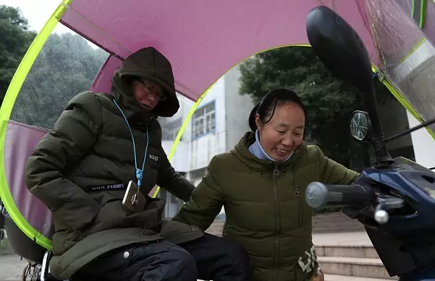 Mei Xiao penyakit  epidermolysis bullosa © 2017 dailystar.co.uk