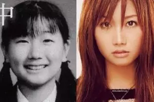 Transformasi 10 seleb Jepang sebelum dan sesudah operasi plastik