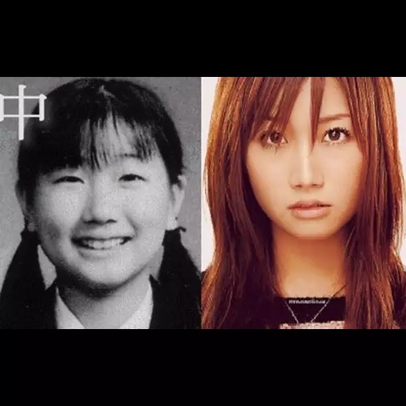 Transformasi 10 seleb Jepang sebelum dan sesudah operasi plastik