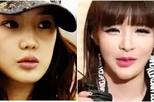 9 Transformasi Park Bom eks 2NE1, idol yang berjuluk 'plastic monster'