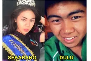 Foto 20 transgender sebelum dan sesudah operasi, bikin syok