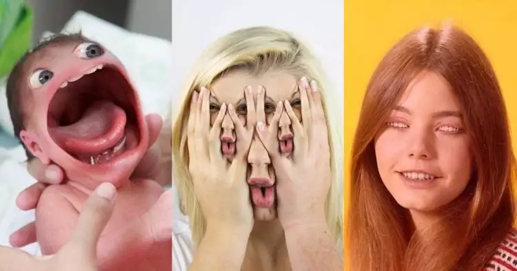 15 Editan foto wajah ini absurd banget, bikin geleng-geleng kepala