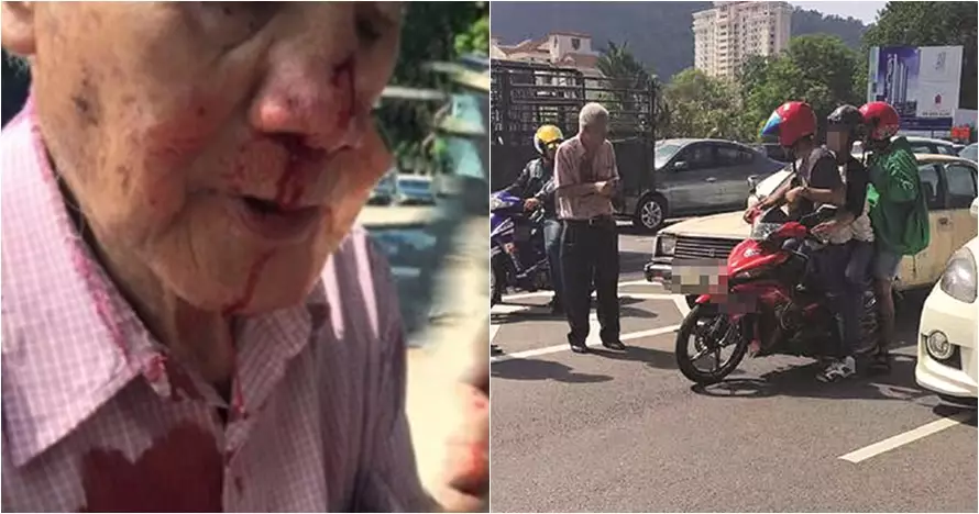 Hentikan mobil karena riwayat jantung, nasib kakek ini malah tragis