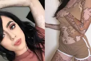 Wanita pengidap vitiligo ini jadikan tubuhnya karya seni mengagumkan