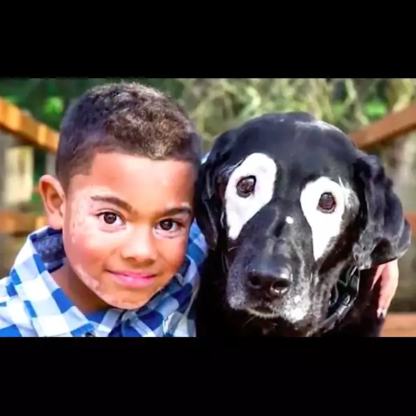 Dijauhi teman sebaya karena vitiligo, bocah ini berkawan dengan anjing
