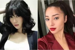 5 Seleb ini pernah pakai filler demi penampilan, gimana perubahannya?