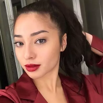 5 Seleb ini pernah pakai filler demi penampilan, gimana perubahannya?