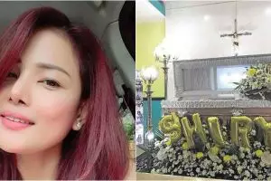 Ingin lebih cantik, cewek ini malah meninggal saat oplas & sedot lemak