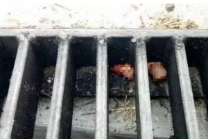 Remaja ini kehilangan dua jarinya karena mengambil dompet, kok bisa?