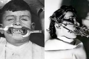 10 Alat kedokteran gigi jadul ini bakal bikin kamu merinding 
