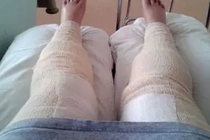 Wanita ini rajin mencukur rambut kemaluan, hasilnya malah bikin ngilu