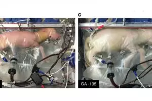 Rahim tiruan ini pulihkan hewan lahir prematur, bisa untuk bayi nggak?