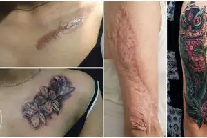 Kreatif maksimal, begini jadinya kalau bekas luka disulap jadi tato