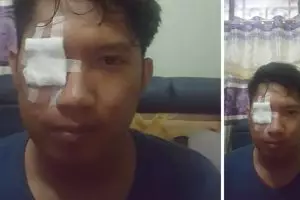 Pria ini kena bara rokok saat bermotor, penyebabnya bikin ikut geram