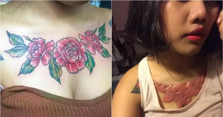 Niat hapus tato, nasib kulit wanita ini malah mengerikan