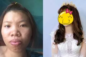Transformasi cewek ini bikin kaget, dulu bak 'upik abu' kini memesona