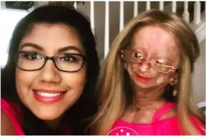 Mengidap penyakit langka, bocah 9 tahun ini sukses jadi selebgram