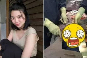 Nggak disangka, apa yang ditemukan dokter di tubuh wanita ini ngeri