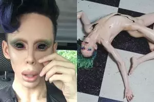 Ingin jadi alien tanpa kelamin, pria ini nekat jalani 110 kali operasi