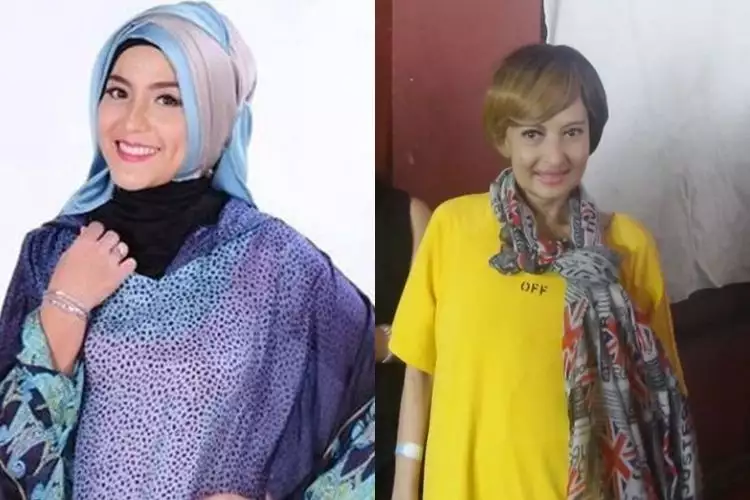 5 Artis Indonesia yang meninggal karena kanker payudara