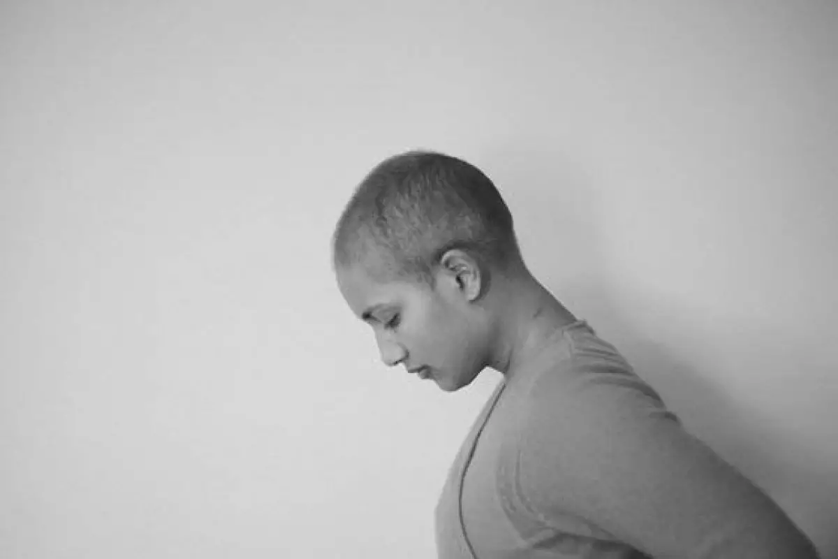 Rambut rontok usai kemoterapi, ini cara penderita kanker mengatasinya