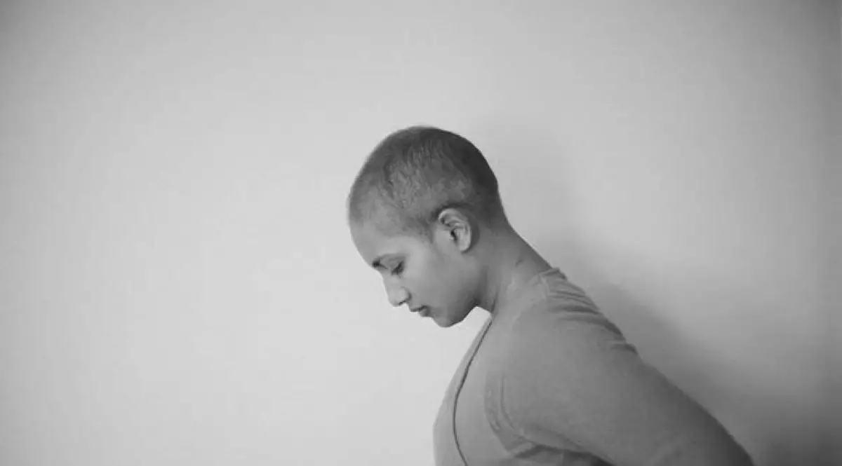 Rambut rontok usai kemoterapi, ini cara penderita kanker mengatasinya