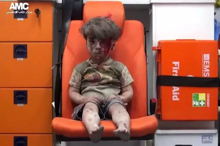 Apa kabar Omran bocah korban Suriah? Sekarang makin imut & chubby