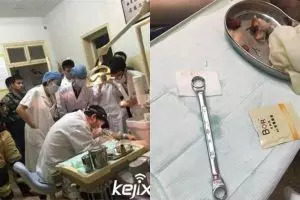 Mr P pria ini masuk kunci ring , yang bisa mencopot hanya dokter gigi