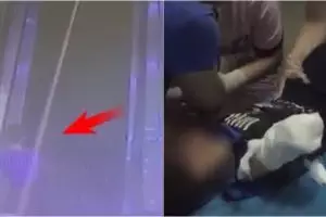 Lengan bocah 4 tahun ini terjepit eskalator di depan mata ibunya 