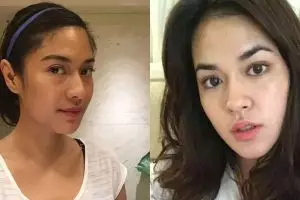 Tak tergoda tanam benang dan filler, 10 aktris ini cantiknya natural