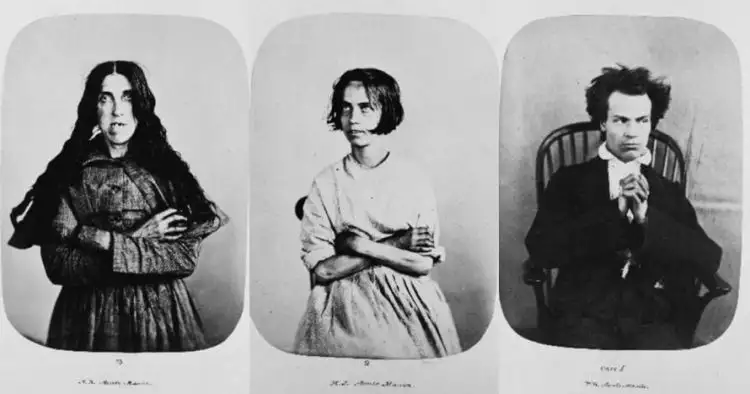 15 Potret pasien rumah sakit jiwa abad ke-19, bikin merinding