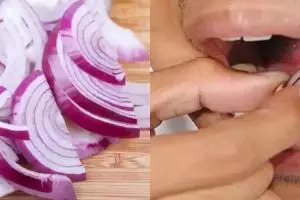 Kamu pasti nggak sadar besarnya manfaat menaruh bawang merah di gigi