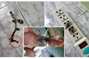 Gelang tangan masuk ke colokan listrik, bayi ini alami luka bakar