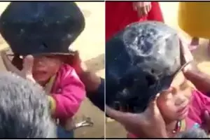  Kepala bocah ini kemasukan kwali, pas bisa dicabut malah dipukul