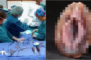 Putus asa melajang, pria ini berhubungan seks dengan tiram