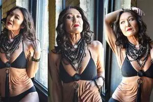 Berkulit gelambir, cewek ini buktikan semua bisa jadi model