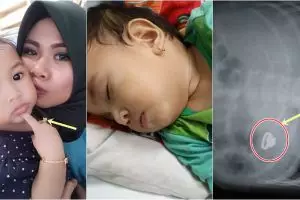 Wanita ini pakaikan anaknya cincin emas tapi malah berujung musibah