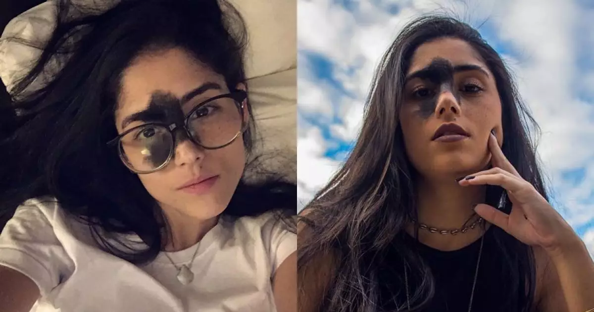 Dibully karena tanda lahir di wajah, cewek ini malah merasa cantik