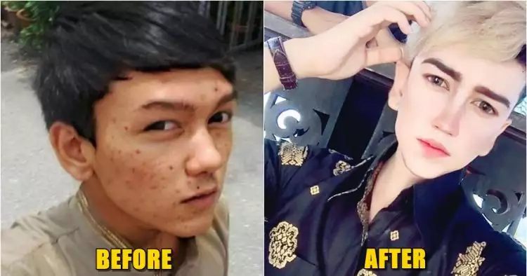 Transformasi wajah cowok ini jadi bahan cibiran netizen