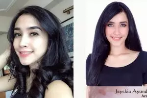 Jeyskia Ayunda, dokter cantik yang juga mantan finalis Putri Indonesia